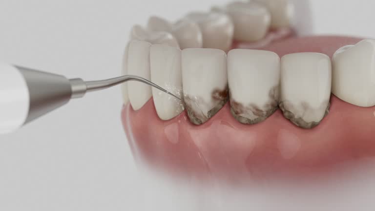 Trusted Dental Crowns And Bridges service in Placerville, CA - Dentist Open Now